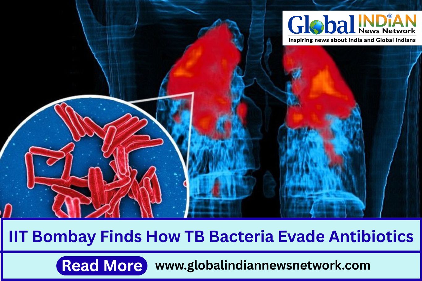 IIT Bombay Finds How TB Bacteria Evade Antibiotics